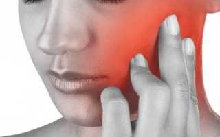 Болит левая челюсть и голова