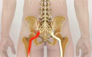 Болит чуть ниже спины что делать