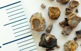 Почему болит спина в пояснице у женщин с левой