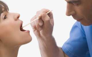 Горло болит гной в горле голова болит