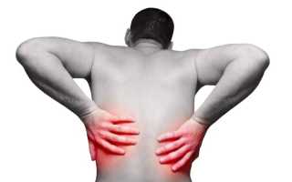 Отчего болит спина сбоку