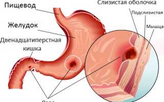 Болит спина отдает в живот опоясывающие боли