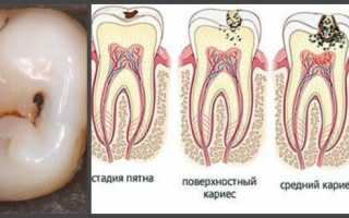 Болит голова отдает зубы