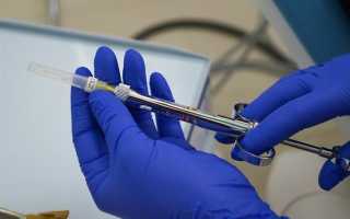 Болит часть головы после удаления зуба