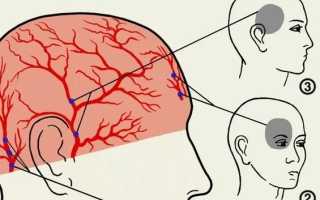 Что делать когда из за глаз болит голова