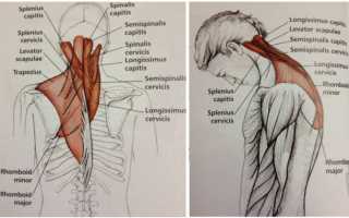 Упражнения когда болит голова