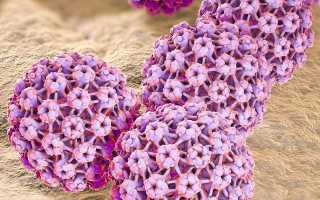 Нарост на спине болит