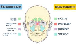 Почему болит при заложенном носе голова и что это может быть