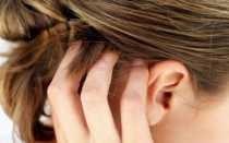 Болят корни волос на голове и выпадают причины