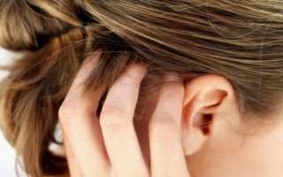 Болят корни волос на голове и выпадают причины