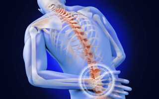 Реальное избавление от болей в спине