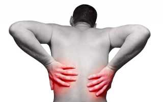 Болит спина по бокам чуть выше поясницы