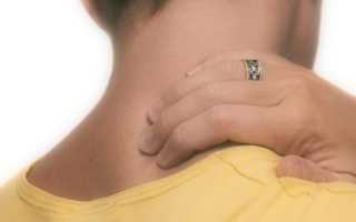 Болит шея кружится голова лечение