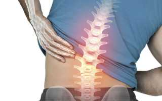 При втягивании живота болит спина