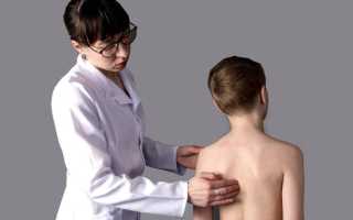 Что может болеть у ребенка 6 лет на спине