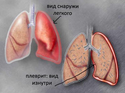 Болит правый бок отдает спину