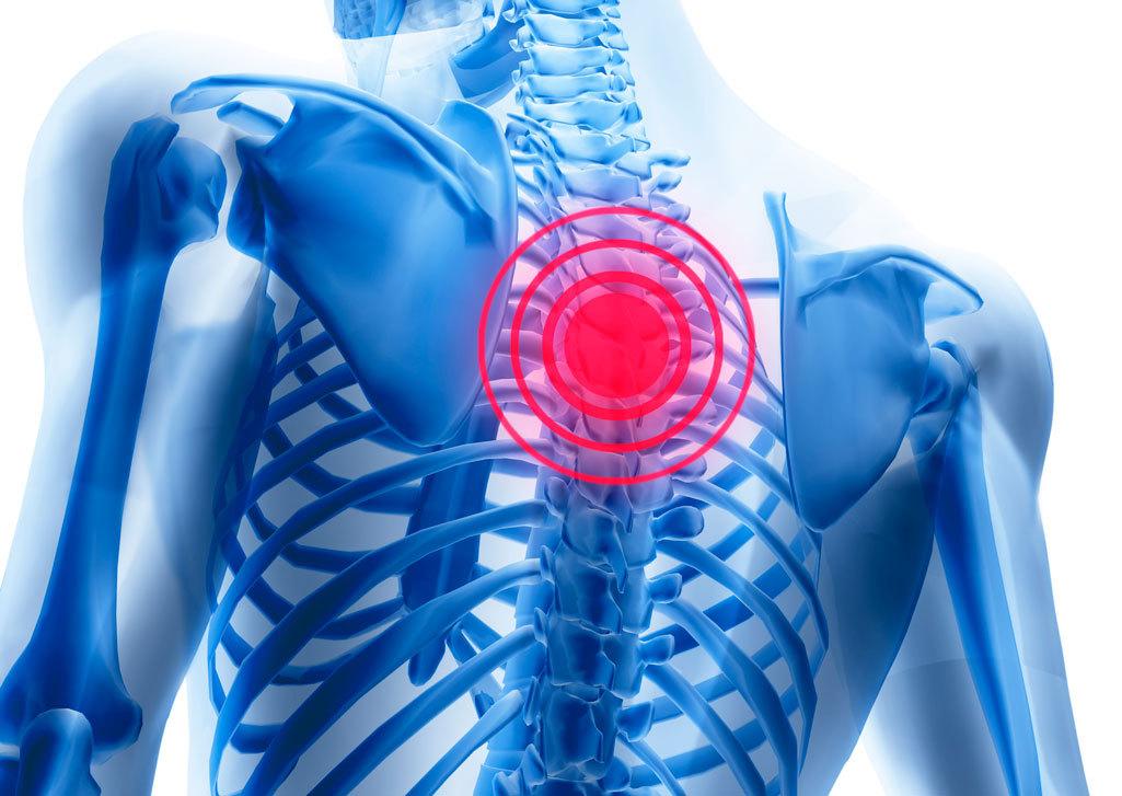 Болит спина в области лопаток к какому врачу обратиться