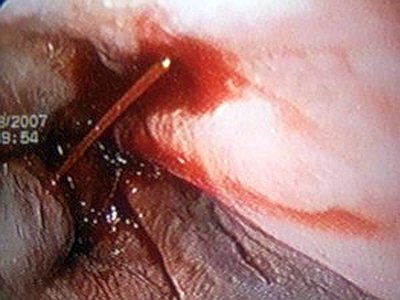 Когда болит спина что делать ребра