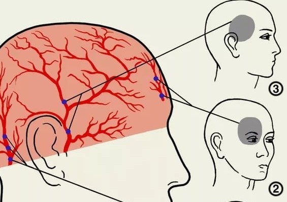 что делать когда из за глаз болит голова
