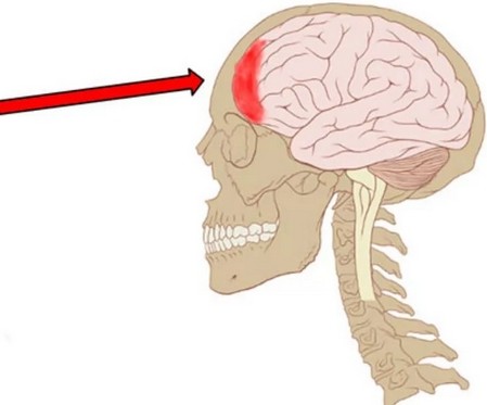 Если болит лобная часть головы что это может быть