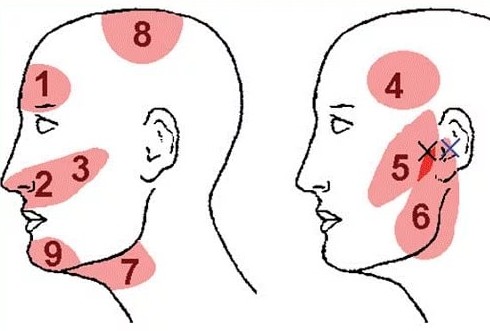 Болит голова стягивает виски