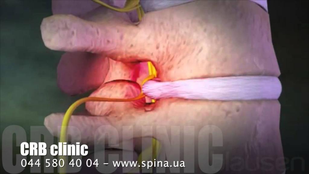 Болит низ спины когда стою