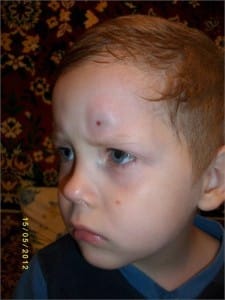 Внешние повреждения Внешние повреждения