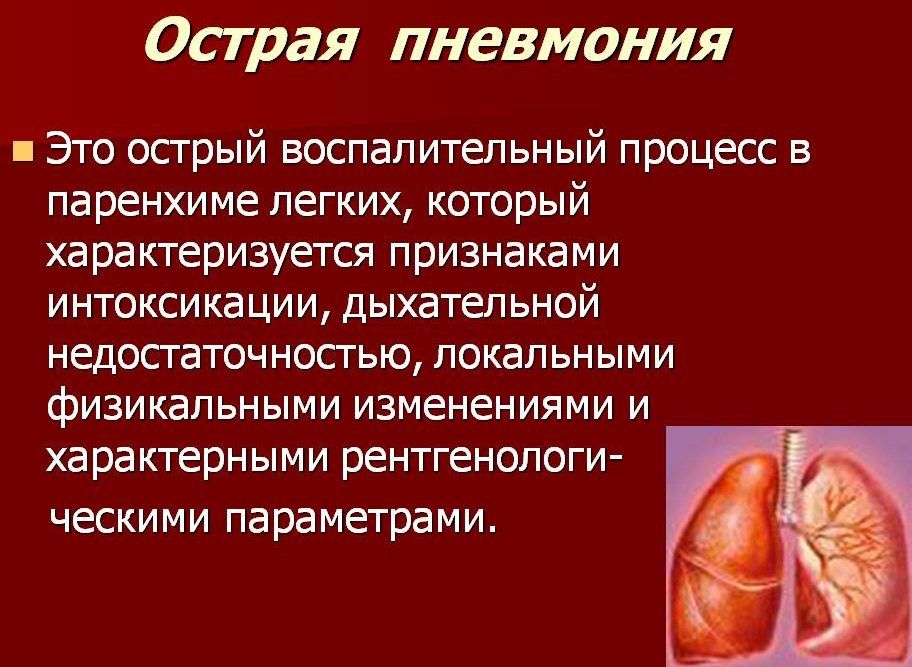 Острая пневмония