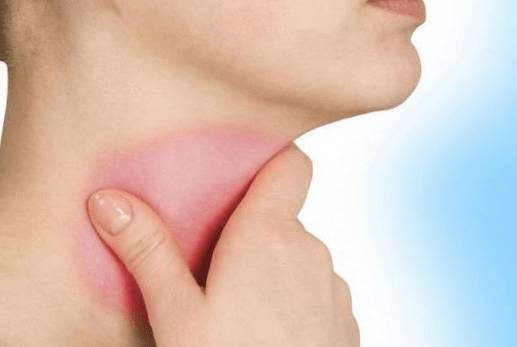 Слабость болит голова т горло но температуры нет что это может быть