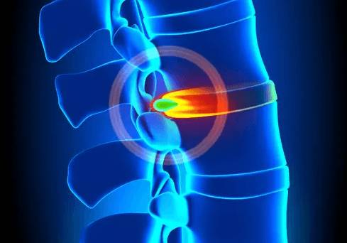 От чего болит спина в области лопаток и шеи