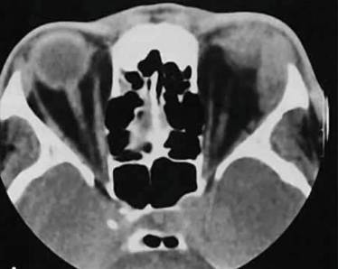 когда спина болит температура бывает