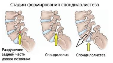 почему болит внизу спины ночью