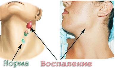 когда спина болит температура бывает