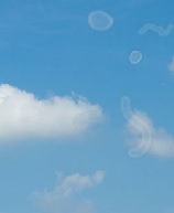 Белые мушки перед глазами