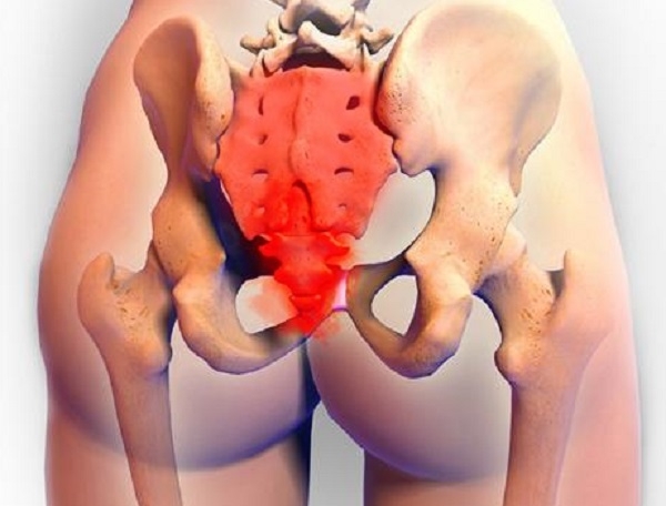 Появление боли в области креcтца Появление боли в области креcтца