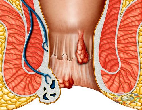 Отчего болит спина сбоку