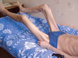 Болит спина у подростка к какому врачу обратиться