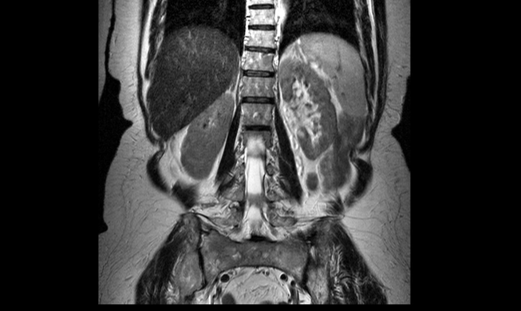 Отчего болит спина сбоку