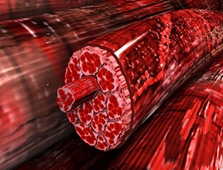 мышечная боль 3