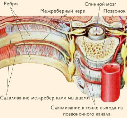 Болит спина онемела лопатка