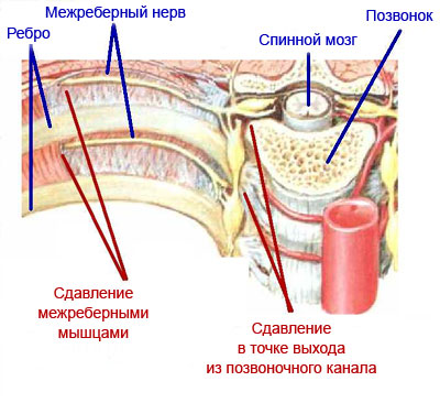 Когда болит спина что делать ребра