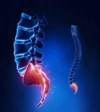 Болит спина в области крестца слева