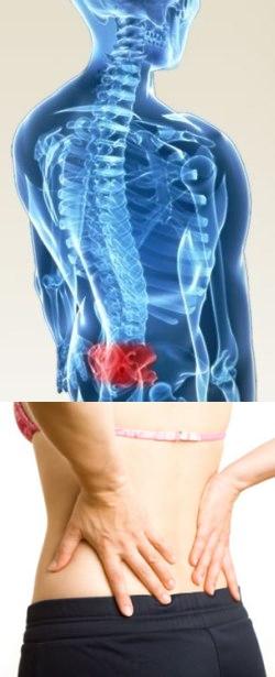 Болит спина в области крестца слева