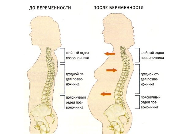 При сидении болит крестец и спина