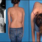 Болит между грудями отдает в спину