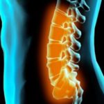 Сильно болит спина в области поясницы при ходьбе