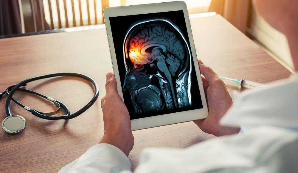 Врач ищет источник мигрени на МРТ