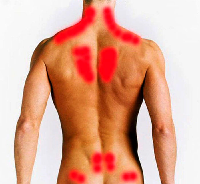 Отчего болит спина сбоку