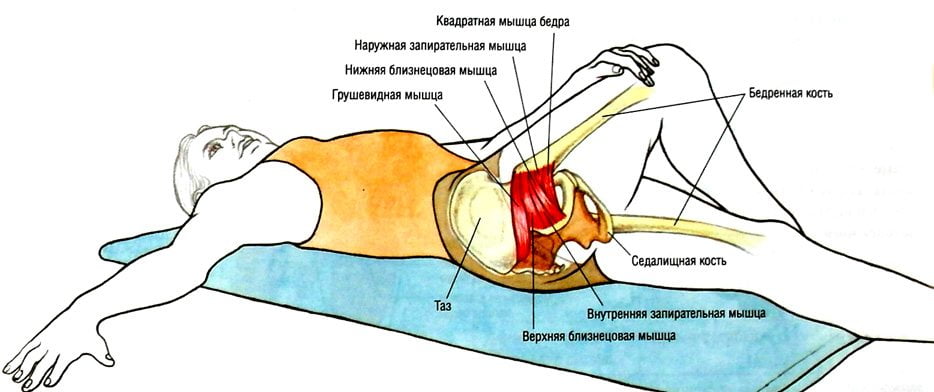 Чем снять синдром грушевидной мышцы