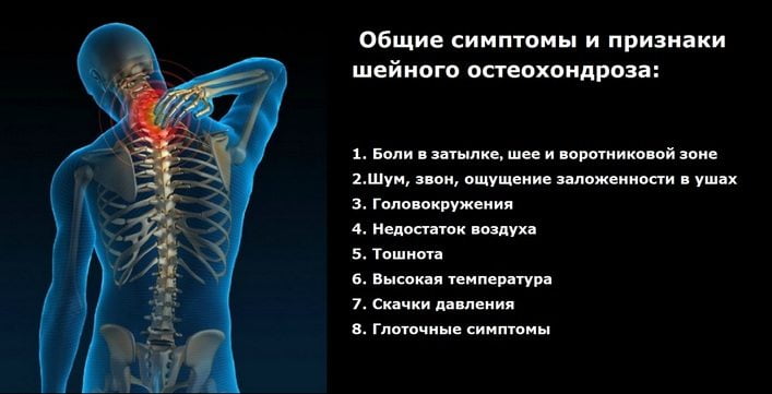 Поясничный остеохондроз с корешковым синдромом что это